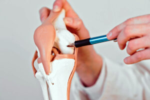 Read more about the article Cartilage Injuries and sportsmen