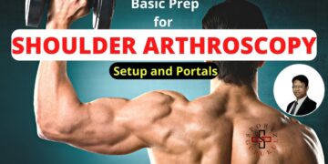 What an Arthroscopic Surgeon Does Before The Scalpel: Key Steps in Prepping for Surgery