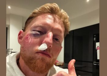 Ben Stokes Left Bloodied After Net Session Mishap