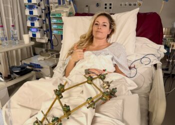 Lindsey Vonn Reveals She Nearly Lost Her Leg After Olympic Crash